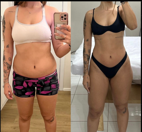 Giovanna antes e depois